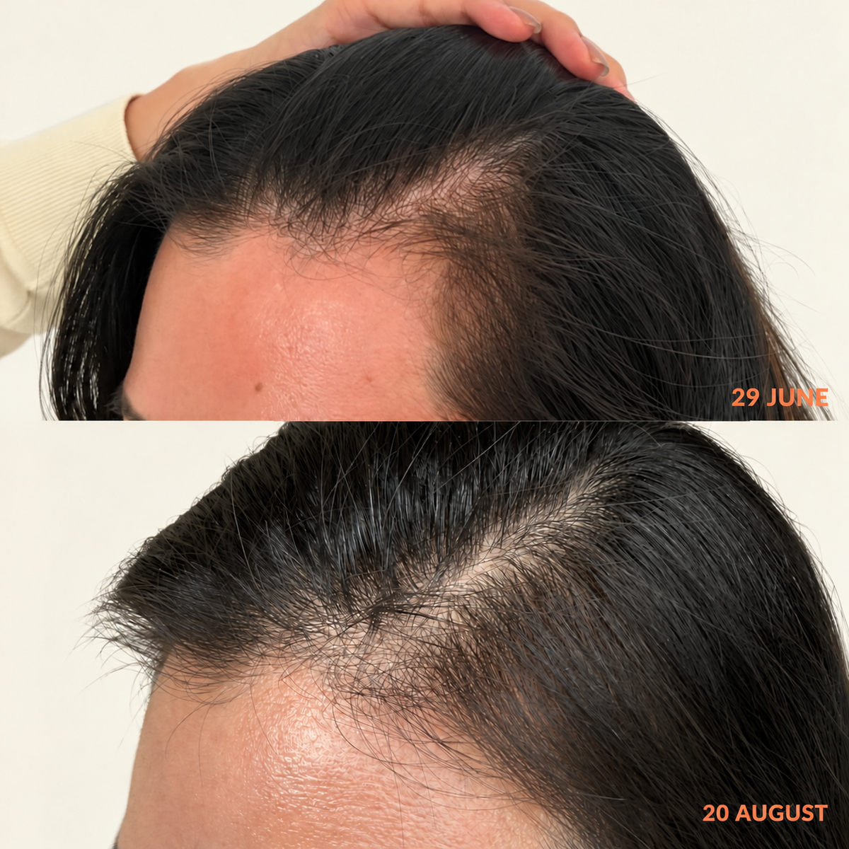 LET IT THRIVE HAIR TONIC