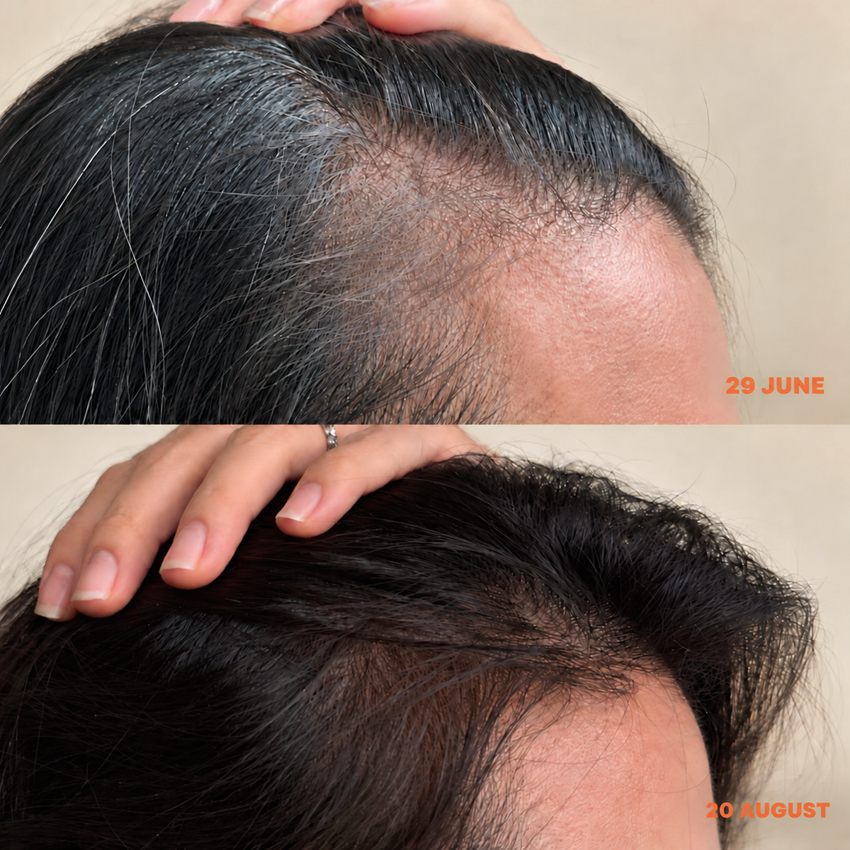 LET IT THRIVE HAIR TONIC